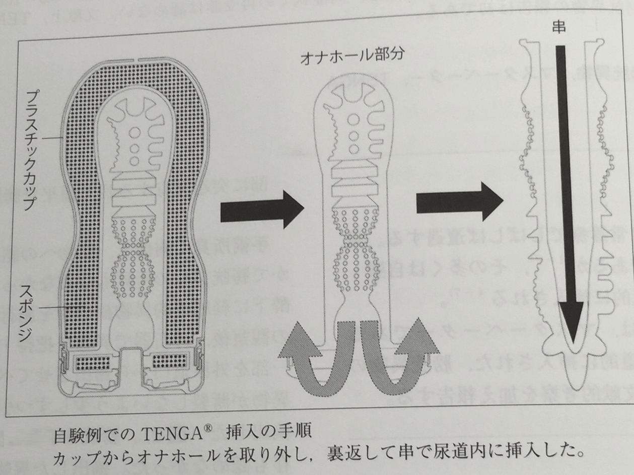 テンガの挿入の手順